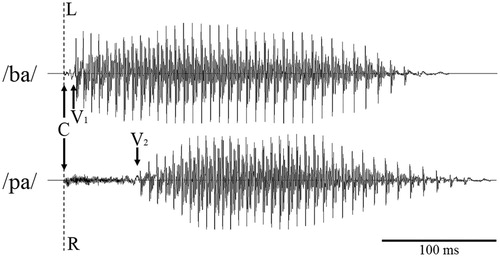 Figure 1. Waveforms for the syllables /ba/ and /pa/ as used in dichotic listening aligned between channels (L, left; R, right) to the onset of the “burst” of the consonant (C). V1 and V2 mark the approximate onset of the vowel in both syllables. The short interval between C and V1 for /ba/ (i.e., the short voice-onset time), is characteristic for voiced syllables. The relative longer voice-onset time, C to V2, for /pa/ is characteristic for an unvoiced syllable. Onset alignment with comparable vowel length leads (a) to offset differences between syllables and (b) to a reduced spectro-temporal overlap between mixed-voicing pairs, like /ba/ and /pa/.