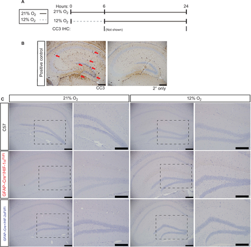 Figure 8 Cell death in the hippocampus does not occur upon 12% O2 exposure.