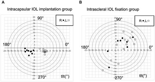 Figure 2 Distribution of intraocular lens (IOL) tilt. Tilt distribution in the intracapsular IOL implantation group (A) and intrascleral IOL fixation group (B) are shown. Black dots indicate right eyes, while white squares indicate left eyes.