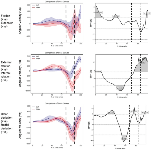 Figure 5. Tri-planar IMU kinematic data for the driver with corresponding statistical parametric analysis “Swing Onset” occurs at 0, the first vertical dotted line indicates the “Top of Swing” event, the second vertical dotted line indicates the “Impact” event and “Swing End” occurs at 100.