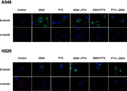 Figure 4 The effect of gemcitabine (GEM) in polymerization microtubule. Cell lines were prepared for immunostaining β-tubulin (green) and α-tubulin (red) after stimulation with the indicated drugs for a total of 48 h. Nuclei were counter-stained with 4’, 6-diamidino-2-phenylindole (DAPI) (blue). Scale bar, 100 μm. Immunofluorescence staining revealed alterations of cellular microtubule structures characterized by the formation of a microtubule bundle. The GEM→PTX sequence appeared to enhance α- and β-tubulin polymerization.