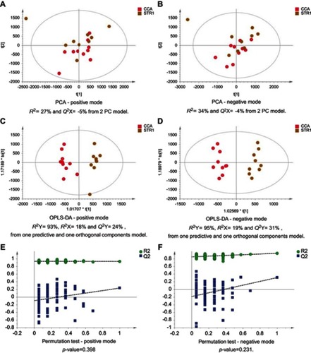 Figure 4 CCA patients vs biliary strictures patients. PCA scores plots for (A) positive and (B) negative ion mode data of CCA patients and biliary strictures patients. OPLS-DA scores plots showing group separation for both (C) positive and (D) negative ion mode data and the corresponding permutation tests for (E) positive and (F) negative ion mode data.