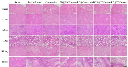 Figure 8 H&E analyses of the main organs and tumor tissues after treatment with various formulations. The scale bar represents 250 μm in the H&E images.