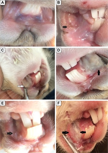 Figure 10 Photographs of rabbit mucosal pouch: (A) normal control, (B) rabbit mucosa immediately after induction, (C) treated group at day 2, (D) nontreated group at day 2, (E) treated group at day 6 and (F) nontreated group at day 6.Notes: Arrow in (B) indicates the presence of hemorrhagic areas and extensive ulcerations. Arrows in (C and D) indicates white fibrous tissue where the ulcer reached its developmental peak. Arrow in (E) shows the healing of ulcerations with mild erythema and hyperemia, no hemorrhagic areas, ulcerations or abscesses. However, the mucositis severity in the control group remained the same or was slightly reduced with severe erythema and hyperemia, presence of hemorrhagic areas and ulcerations, as shown by the arrows in (F).