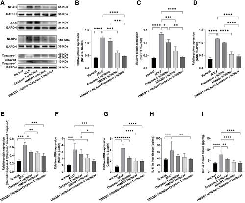 Figure 3 HMGB1 induced hepatocyte pyroptosis in ACLF rats by activating the Caspase-1-dependent pyroptosis pathways.