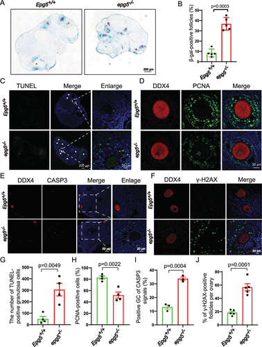 Figure 3. Epg5 knockout results in GCs aging and cell death. (a) Histoenzymatic detection of GLB1/β-gal. The blue indigo precipitates (resulting from X-Gal lysis by GLB1/β-gal) are evident in the GCs of 12-week-old epg5 knockout mice. The red asterisks indicate follicles positive for GLB1/β-gal signals. Scale bar: 200 µm. (b) Quantification of GLB1/β-gal-positive GCs in ovary sections (n = 5 for each of the indicated groups). (C) TUNEL assay to evaluated GC apoptosis in 12-week-old epg5 knockout and control ovaries. The white asterisks indicate follicles positive for TUNEL. Scale bars: 200 µm, 20 µm. (g) Quantitative analysis of TUNEL-positive cells of ovary sections in C (n = 4 for each group). (d) PCNA immunofluorescence assays and (h) the quantification of PCNA positive granulosa cells in epg5 knockout and control ovaries are shown (n = 4 for each group). Scale bars, 20 µm. (e) CASP3 Immunofluorescence analysis of epg5 knockout and control ovaries sections. Scale bars: 50 µm, 20 µm. (i) Quantitative analysis of CASP3-positive cells of ovary sections in E (n = 3 for each group). (f) γ-H2AX immunofluorescence assays and J the quantification of γ-H2AX positive GCs in epg5 knockout and control ovaries are shown (n = 5 for each group). Scale bars: 20 µm. Data are expressed as the mean ± S.E.M.