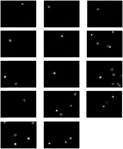 Figure 4. Fluorescence microscopy images of cells of some controls.