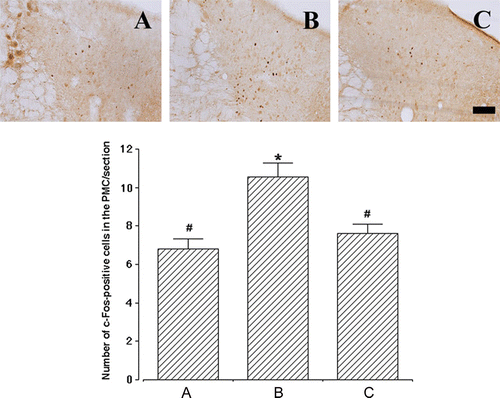 Figure 3.  Effect of human adipose-derived stem cells (ADSCs) on c-Fos expression in the pontine micturition center (PMC). Upper panels: representative photomicrographs of c-Fos-positive cells in the PMC. The sections were stained for c-Fos-like immunoreactivity (brown) as described in Materials and methods. The scale bar represents 100 µm. Lower panel: the mean number±SEM of c-Fos immunoreactivity in sham-operation (A), SUI-induction (B) and SUI-induction followed by human ADSC injection (C) groups. *represents P<0.05 compared with the sham-operation group and #represents P<0.05 compared with the SUI-induction group.