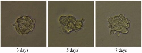 Figure 35. Gold nanoparticle (AuNP) treatment group for 3D tumour spheroid. Scale bar = 100 μm.