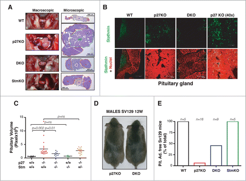 Figure 4. Stathmin loss suppresses the development of pituitary adenomas of p27KO mice. (A) Representative images of pituitary glands from 1-year-old C57BL/6 mice (outlined in black) of the indicated genotypes, photographed in situ (left panels, macroscopic) or H&E stained and captured with a 5x objective (right panels, microscopic). The pars posterior (p, in blue), the pars intermedia (i, yellow), the pars anterior (a, red) and the adenoma (ad, green) are outlined. (B) Confocal images of immunofluorescence analysis of stathmin (in green) and nuclei (in red) in pituitary gland sections from WT (10x), p27KO (10x and 40x) and DKO (10x) 1-year-old C57BL/6 mice. Bottom panels represent the merge of the 2 staining. (C) Graph shows pituitary gland volume of 1-year-old C57BL/6 mice of the different genotypes, as indicated. (D) Representative images of 12-weeks-old 129S2/Sv (SV129) male mice of the indicated genotypes. (E) Graph shows the number of 129S2/Sv (SV129) mice of the indicated genotypes (5-9 months old) that did not developed pituitary adenomas. The number of analyzed mice is reported in the graph.