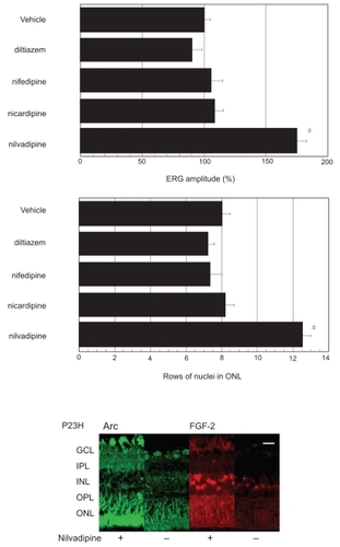 Figure 4 Effects of several Ca2+ channel blockers on retinal function and morphology in P23H rats. P23H rat were treated with Ca2+ channel blockers, D-cis-diltiazem, nifedipine, nicaridipine nilvadipine or their vehicle solutions and thereafter retinal function by ERG and morphological analysis (upper panel) were performed. ERG measurements were performed in 10 eyes (5 rats) in each condition, and b-wave amplitudes of drug treated rats were compared with those of vehicle treated rats. Hematoxyline-eosine stained retinal sections at 1mm from optic disc of P23H rat eyes treated as above were photographed, and rows of ONL nuclei were analyzed as described in Materials and methods.