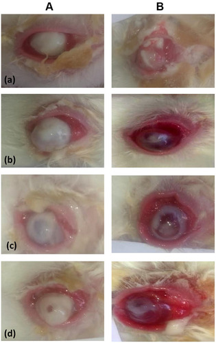 Figure 6 Conjunctival hyperemia and corneal edema in rabbits with Pseudomonas-induced keratitis pre- (A) and 10 days post- (B) non-treatment in the infected group (a) or treatment in drug suspension- (b), G3- (c), G4- (d) groups.