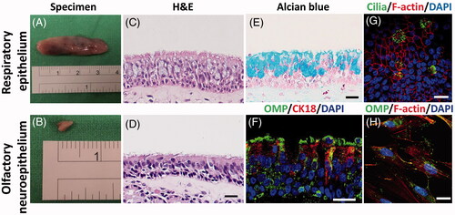 Figure 1. Tissue specimens of human RE (A) and ON (B). Sections through the human RE and ON stained with hematoxylin and eosin (H&E) (C–D) and Alcian blue (E). Paraffin-section of representative ON is immunostained for OMP and CK18 . Nuclei are labeled with DAPI (F). Immunofluorescence images of cultured RECs and ONCs. Cilia (G) and OMP (H) are identified with DyLight488. Cellular cytoskeletal shape (F-actin) is outlined by rhodamine phalloidin. Scale bar= 20 μm.