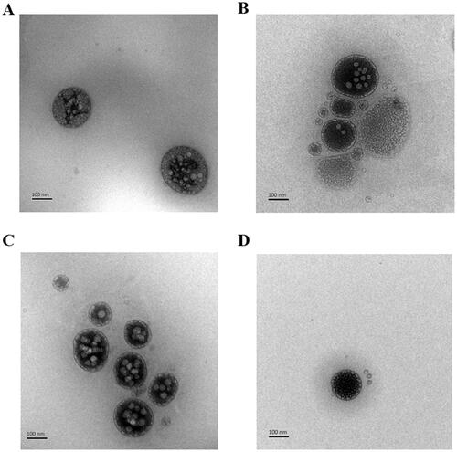 Figure 3. Transmission electron photomicrographs of CTD liposomes. (A) CTD-lip; (B) SA-Gal-CTD-lip; (C) 11-DGA-Suc-CTD-lip; (D) (11-DGA-Suc + SA-Gal)-CTD-lip.