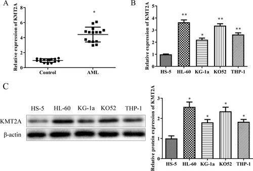 Figure 1. KMT2A is up-regulated in AML PB as well as cell lines. (A) KMT2A expression in AML PB was discovered using a qRT-PCR assay. *P < 0.05 vs. control group. KMT2A mRNA, together with protein expressions, was found using (B) qRT-PCR as well as (C) western blot assays in AML cell lines. *P < 0.05, **P < 0.01 vs. HS-5 cells. All data were exhibited as mean ± SD. n = 3.