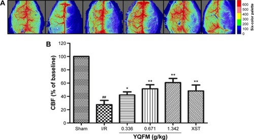 Figure 3 Effect of YQFM on regional cerebral blood flow in mice with cerebral I/R.
