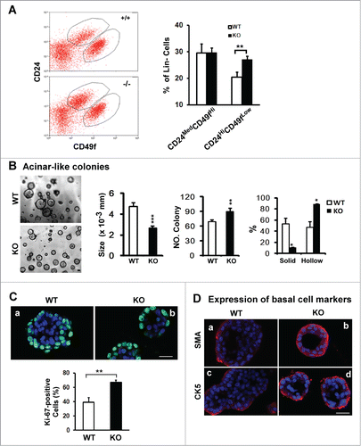 Figure 3. For figure legend, see page 2713.Figure 3 (See opposite page). Effect of CD151 removal on distribution, proliferation and differentiation of luminal progenitor cells in mammary glands. (A) Left panel: Typical plots of cell subpopulations within the Lin− population residing in mammary glands. Lin− populations were prepared from10–14 week old FVB/Sv129 mice and then sorted on flow cytometry using a combination of FITC or APC-conjugated monoclonal antibodies against CD24 and CD49f antigens. Right panel: Average portions of CD24MedCD49fHi and CD24HiCD49fLow subpopulations within Lin− populations prepared from CD151 WT and null mouse littermates (mean ± SEM, n = 3). (B) Left panel: Representative images of acinar-like colonies formed by CD24Hi CD49fLow subpopulation after 3 weeks of 3D culture. Right panel: Changes in the size, number and percentage of solid and hollow colonies (n = 5). (C and D) Staining of Ki67 or smooth muscle actin (SMA) or cytokeratin 5 (CK5) in the acinar-like colonies formed by the CD24HiCD49fLow fraction prepared from CD151 WT or KO mice. Green/Red: Antibody staining. Blue: DAPI for nuclei. Percentages of Ki67-positive cells were determined microscopically in multiple representative fields. For (B and C), values (mean ± SEM) were calculated from 3 independent experiments. For (A–C), *: P value <0 .05, **: P value <0.01. All images and measurements in (B–D) are representative of at least 3 independent experiments. Scale bars for (B–D): 50 μm.