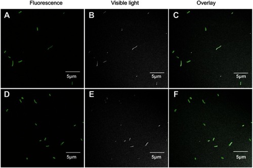 Figure 4 LCSM observation of antimicrobial peptide Cec4 distribution in A. baumannii (A) 1× MIC Cec4 treated A. baumannii 30 min fluorescence picture; (B) 1× MIC Cec4 treated A. baumannii 30 min bright field map; (C) 1× MIC Cec4 treated A. baumannii 30 min overlay; (D) 1× MIC Cec4 treated A. baumannii 60 min fluorescence picture; (E) 1× MIC Cec4 treated A. baumannii 60 min bright field map; (F) 1× MIC Cec4 treated A. baumannii 60 min overlay.