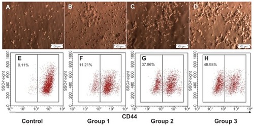 Figure 3 In vitro CD44 down-regulation using the CD44 shRNA lentiviral vector with doses of infectious units to breast cancer stem cells at ratios 1:0 (A and E), 2:1 (B and F), 1:1 (C and G) and 1:2 (D and H).