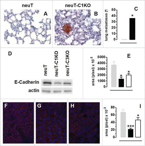 Figure 2. C1q deficiency is associated with anticipated metastatic spread and epithelial-to-mesenchymal transition in neuT tumors. Histological and immunohistochemical staining for Her2/neu of lungs from 17-week-old neuT (A) and neuT-C1KO (B) mice reveal earlier metastatic infiltration in neuT-C1KO mice. Magnification × 400. (C) Percentage of neuT (n = 19, gray bar) and neuT-C1KO (n = 14, black bar) mice (*p = 0.05 Chi-square test) bearing lung metastatic lesions at 17 weeks of age. (D–I) Decreased expression of E-Cadherin in neuT-C1KO and neuT-C3KO vs. neuT tumors. (D) E-Cadherin (upper panel) and actin (lower panel) protein levels as measured using the immunoblotting of whole cell lysates from 6–8 mm mean diameter carcinomas. A representative blot from three independent experiments is shown. (E) Quantification of E-Cadherin protein expression in neuT (gray bar), in neuT-C1KO (black bar) and neuT-C3KO (white bar) tumors (*p < 0.05, two-tailed Student's t-test). (F–H) Representative microscopy images of tumor sections from neuT (F), neuT-C1KO (G), and neuT-C3KO (H) mice (n = 3 per group) labeled with anti-E-Cadherin antibody (red) and DAPI (blue, labeling nuclei). Magnification × 400. (I) E-Cadherin protein was quantified in neuT (gray bar), neuT-C1KO (black bar) (***p < 0.0001, two-tailed Student's t-test) and neuT-C3KO (white bar) tumors (*p = 0.04, two-tailed Student's t-test). Results are represented as means ± SEM.