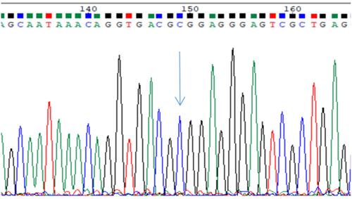 Figure 2 Homozygous CC sequencing diagram, blue single peak indicated by arrow (location 149).