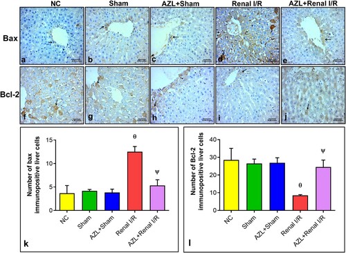 Figure 5. Photomicrographs of immunohistochemical staining of Bax and Bcl-2 in liver sections from sham and renal ischemic rats. (a, b & c): NC, Sham and AZL + Sham groups showing few Bax immunopositive liver cells. (d): Renal I/R group showing extensive Bax immunopositive liver cells. (e): AZL + Renal I/R group showing that some liver cells are BAX positive cells. (f, g & h): NC, Sham and AZL + Sham groups showing abundant Bcl-2 immunoreactions in most hepatocytes. (i): Renal I/R group revealing an apparent decline in Bcl-2 immunoreactions in most of the hepatocytes. (j): AZL + Renal I/R group demonstrating extensive Bcl-2 immunoreactivity in liver cells more or less as control groups (Avidine biotin peroxidase stain with Hx counter stain; Magnification x400, scale bar = 50 µm). (k & l): Quantification of Bax and Bcl-2 immunoexpressions in liver tissue of rats, respectively. Each bar represents the mean ± SD of four rats per group; ϴp < 0.001 vs. NC and sham control groups; ΨP < 0.001 vs. Renal I/R group.