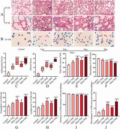 Figure 2. (A) Optical microscope pictures of lung tissue sections; (B) Giemsa staining of alveolar lavage fluid cells (10 × 100); (C) inflammation score; (D) fibrosis score; (E) total cells count per field; (F) macrophages; (G) neutrophils; (H) lymphocytes; (I) percentage of monocytes; (J) percentage of macrophages. *p < 0.05, **p < 0.01, ***p < 0.001 and ****p < 0.0001.