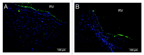 Figure 7. A continuous endothelial lining along the endocardial surface was observed in (A) C-ECM and (B) UBM scaffolds as evidenced by von Willebrand factor (green; draq5, blue). Scale indicates 100 µm.