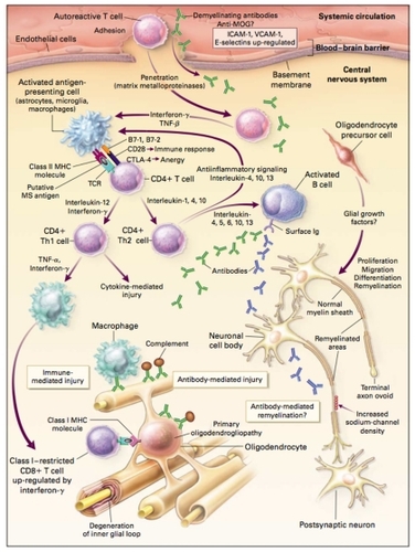 Figure 2 Possible mechanisms of injury and repair in MS. Genetic and environmental factors (including viral infection, bacterial lipopolysaccharides, superantigens, reactive metabolites, and metabolic stress) may facilitate the movement of autoreactive T cells and demyelinating antibodies from the systemic circulation into the CNS through disruption of the BBB. In the CNS, local factors (including viral infection and metabolic stress) may upregulate the expression of endothelial adhesion molecules, such as ICAM-1, VCAM-1, and E-selectin, further facilitating the entry of T cells into the CNS. Proteases, including matrix metalloproteinases, may further enhance the migration of autoreactive immune cells by degrading extracellular-matrix macromolecules. Proinflammatory cytokines released by activated T cells, such as IFN-γ and TNF-β, may upregulate the expression of cell-surface molecules on neighboring lymphocytes and antigen-presenting cells. Binding of putative MS antigens, such as myelin basic protein, myelin-associated glycoprotein, MOG, proteolipid protein, αβ-crystallin, phosphodiesterases, and S-100 protein, by the trimolecular complex – the TCR and class II MHC molecules on antigen-presenting cells – may trigger either an enhanced immune response against the bound antigen or anergy, depending on the type of signaling that results from interactions with surface costimulatory molecules (eg, CD28 and CTLA-4) and their ligands (eg, B7-1 and B7-2). Downregulation of the immune response (anergy) may result in the release of anti-inflammatory cytokines (IL-1, IL-4, and IL-10) from CD4+ T cells, leading to the proliferation of anti-inflammatory CD4+ Th2 cells. Th2 cells may send anti-inflammatory signals to the activated antigen-presenting cells and stimulate pathologic or repair-enhancing antibody-producing B cells. Alternatively, if antigen processing results in an enhanced immune response, proinflammatory cytokines (eg, IL-12 and IFN-γ) may trigger a cascade of events, resulting in the proliferation of proinflammatory CD4+ Th1 cells and ultimately in immune-mediated injury to myelin and oligodendrocytes. Multiple mechanisms of immune-mediated injury of myelin have been postulated: cytokine-mediated injury of oligodendrocytes and myelin; digestion of surface myelin antigens by macrophages, including binding of antibodies against myelin and oligodendrocytes (ie, antibody-dependent cytotoxicity); complement-mediated injury; and direct injury of oligodendrocytes by CD4+ and CD8+ T cells. This injury to the myelin membrane results in denuded axons that are no longer able to transmit action potentials efficiently within the CNS (loss of saltatory conduction). This slowing or blocking of the action potential results in the production of neurologic symptoms. The exposed axon segments may be susceptible to further injury from soluble mediators of injury (including cytokines, chemokines, complement, and proteases), resulting in irreversible axonal injury (such as axonal transection and terminal axon ovoids). There are several possible mechanisms of repair of the myelin membrane, including resolution of the inflammatory response followed by spontaneous remyelination, spread of sodium channels from the nodes of Ranvier to cover denuded axon segments and restore conduction, antibody-mediated remyelination, and remyelination resulting from the proliferation, migration, and differentiation of resident oligodendrocyte precursor cells.Copyright © 2000, Massachusetts Medical Society. All rights reserved. Adapted with permission from Noseworthy JH, Lucchinetti C, Rodriguez M, Weinshenker BG. Multiple sclerosis. N Engl J Med. 2000;343(13):938–952.Citation2