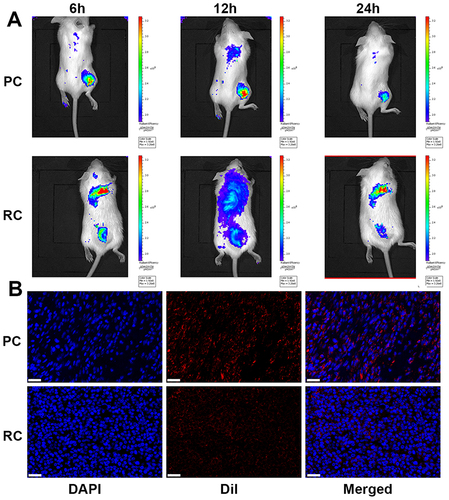 Figure 3 Tumor-specific targeting of PC. (A) Fluorescence imaging of mice administrated with PC or RC at different time intervals. (B) Immunofluorescence staining of tumors from mice treated with PC or RC (Scale bar: 30 μm).