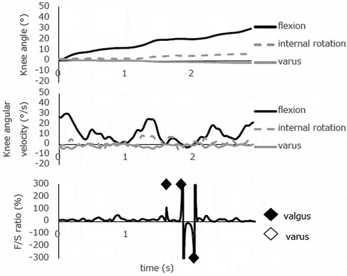 Figure 4c. Knee biomechanics during a slow, single-leg squat from 0° to 30° knee flexion in subject 3. Quantitative analysis of the F/S spikes detected one valgus KW at 15-20° knee flexion and two valgus KWs at 20-25° knee flexion during the descending phase of the first squat. This case presented decreasing knee flexion near 20° knee flexion