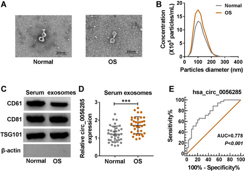 Figure 8 Circ_0056285 was highly expressed in serum exosomes of OS patients. (A) Representative images of serum exosomes were examined by TEM. (B) Size distribution was analyzed by NTA. (C) Exosome markers (CD61, CD81 and TSG101) were detected by Western blot. (D) Circ_0056285 expression in serum exosomes of OS patients (n=35) and healthy volunteers (n=35) was measured by qRT-PCR. (E) ROC curve was used to evaluate the diagnostic value of exosomal hsa_circ_0056285 in OS. ***P < 0.001.