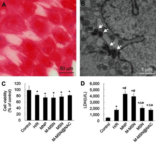 Figure 2 Effects of different NPs on cardiomyocytes viability and injury. (A-B) Prussian blue staining and TEM image showed the accumulation of iron-containing nanoparticles in cardiomyocytes following incubation with M-MSN@NAC for 24 hrs. White arrows denote the M-MSN@NAC or particulate matter. (C) Cell viability was measured by CCK-8. (D) Cell toxicity was evaluated by LDH leakage. Data were collected from three independent experiments. (*p<0.001 vs Control; #p<0.0001 vs H/R; Δp<0.001 vs MNP; ☆p<0.001 vs M-MSN).Abbreviations: NPs, nanoparticles; TEM, transmission electron microscopy; LDH, lactate dehydrogenase; H/R, hypoxia/reoxygenation; MNP, magnetic iron oxide nanoparticles; MSN, mesoporous silica nanoparticles; M-MSN, magnetic mesoporous silica nanoparticles; M-MSN@NAC, M-MSN loaded with NAC.