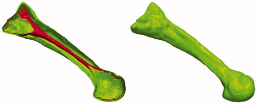 Figure 1. Example of segmented trabecular (inner) and cortical (outer) bone..