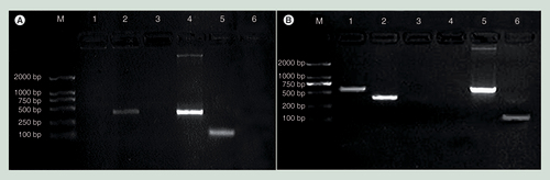 Figure 3.  Transcription of the HBV X and HBV S genes in sperm transfected with a methylated plasmid and in sperm-derived embryos. (A) In sperm. M: marker DL2000; 1: X gene; 2: S gene; 3: -RT; 4: positive control; 5: β-actin; and 6: -T. (B) In sperm-derived embryos. M: marker DL2000; 1: X gene; 2: S gene; 3: -T; 4: -RT; 5: positive control; 6: β-actin.