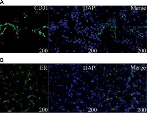 Figure 4 (A, B) Laser scanning confocal microscope of CD31 and ER-α. Immunofluorescence analysis showed that DAPI was stained blue in the nucleus and CD31 and ER-α were positively expressed in the cytomembrane.