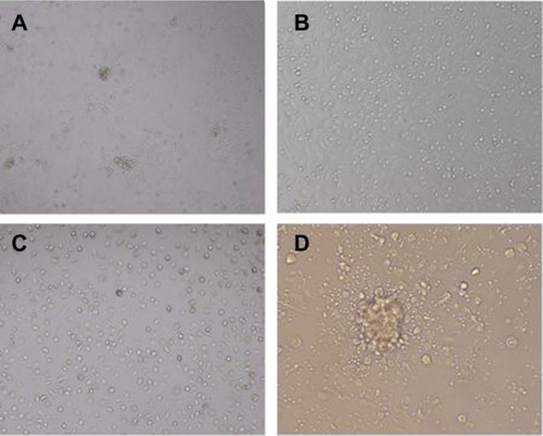 Figure 1 Granuloma-like aggregates formed by cocultivation of three different bacilli and two kinds of immune cells.