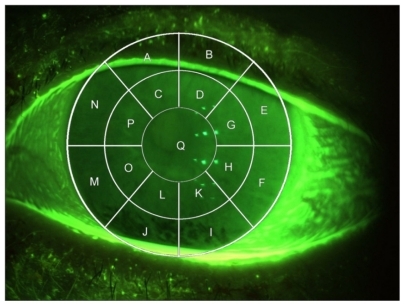 Figure 1 Corneal transect grid used to score corneal regions.