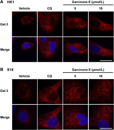 Figure 8. Effect of garcinone E on lysosome damage in HK1 and S18 cells. (A, B) Immunofluorescence images showed the fluorescence of galectin-3 antibody (red) in HK1 and S18 cells after treatment with DMSO, garcinone E (5 and 10 μmol/L), or 10 μmol/L chloroquine (CQ) for 48 h. Images were taken with a confocal microscope. Scale bar: 20 μm.