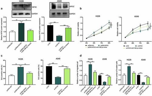 Figure 5. Effects of miR-186-3p / KIF3C axis on NSCLC cell proliferation, migration, and invasion a. H226 cells were co-transfected with pcDNA-KIF3C and miR-186-3p mimics, and A549 cells were co-transfected with si-KIF3C and miR-186-3p inhibitors. After transfection, KIF3C expression was detected by Western blot. B&C. CCK-8 and EdU assays were conducted to detect the changes in cell proliferation. D&E. Transwell assays were performed to detect the changes in cell migration and invasion. * P < 0.05, ** P < 0.01 and *** P < 0.001