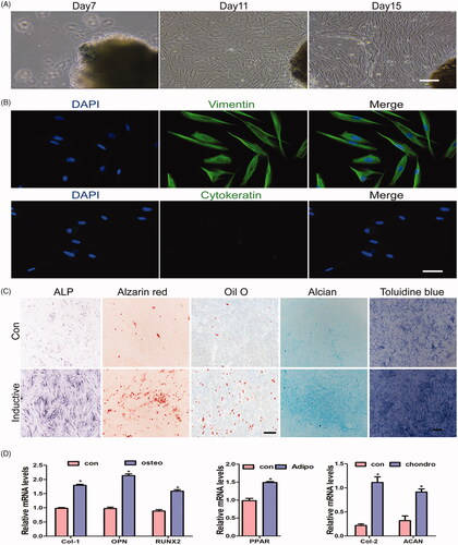 Figure 2. Characterisation of human GMSCs obtained from gingival tissue. (A) Representative images of primary cells grown from human gingival tissue and at days 7, 11, and 15. Scale bars: 100 μm. (B) Representative images of gingival tissue primary cells subjected to immunofluorescence staining. Cells were negative for cytokeratin and positive for vimentin (green) expression; nuclei were stained with DAPI (blue). Scale bars: 100 μm. (C) Representative images of cells cultured with normal and inductive medium and stained with ALP, Alizarin Red S, Oil Red O, alican blue and toluidine blue. Scale bars: 100 μm. (D) qRT-PCR analysis for the expression levels of Col-1, Runx2, OPN,PPARγ, Col-2 and ACAN treated with normal and inductive medium, respectively. Scale bars: 100 μm. *p < .05.