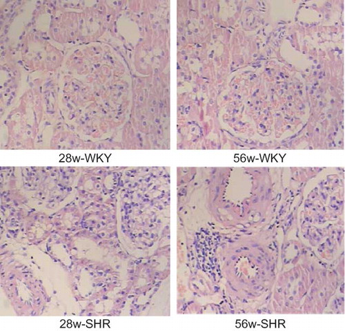 Figure 1. Hypertension-induced kidney injury in the rats. HE staining of renal tissue of 28w-WKY, 56w-WKY, 28w-SHR, and 56w-SHR (original magnification ×400).