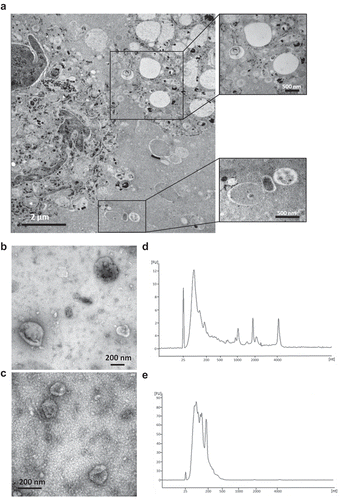 Figure 1. EVs in melanoma metastases tissue interstitial space were isolated and characterized. (a) Melanoma metastatic tissue consisted of cells containing melanin accumulations and EVs. Higher magnification pictures showed numerous different types of EVs in the tissue interstitial space. (b-e) Characterization of 16.5k and 118k EVs. Electron microscope images of 16.5k (b) and 118k (d) EVs. The 16.5k EVs have a size range of 100–300 nm, and the 118k EVs have a diameter of approximately 40–100 nm. RNA profiles of 16.5k (c) and 118k (e) EVs. The 16.5k EVs have prominent 18S and 28S ribosomal RNA peaks, whereas the 118k EVs have small RNA with no or very small ribosomal RNA peaks.