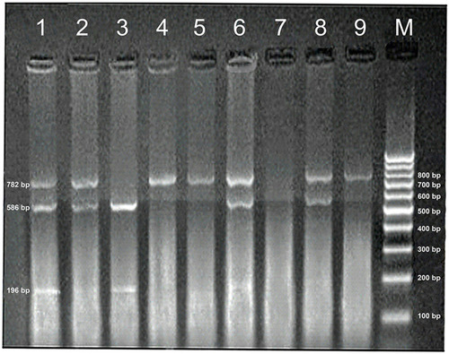 Figure 1 Representative gel picture showing PCR-RFLP analysis of NcoI LTA gene polymorphism on ethidium bromide-stained 2% agarose gel. M stands for molecular size marker (100 bp DNA ladder); lane 3 represents homozygous G/G genotype; lanes 1,2,6,8 represents heterozygous A/G genotype, and lanes 4,5,9 represents homozygous A/A genotype.