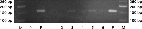 Figure 1. P. gingivalis specific 16S rRNA gene amplicons from DNA of oral swabs after electrophoresis on a 3% agarose gel. 1–2: sham-infected mice (controls); 3–4: W83-treated mice; 5–6: TDC60-treated mice; N: negative control; P: positive control (expected amplicon size: 161 bp). M: molecular weight marker (Quick-Load Low Molecular Weight DNA Ladder, NEB®).