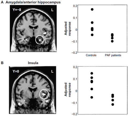 Figure 3 Brain and body interact to affect the perception and expression of fear.