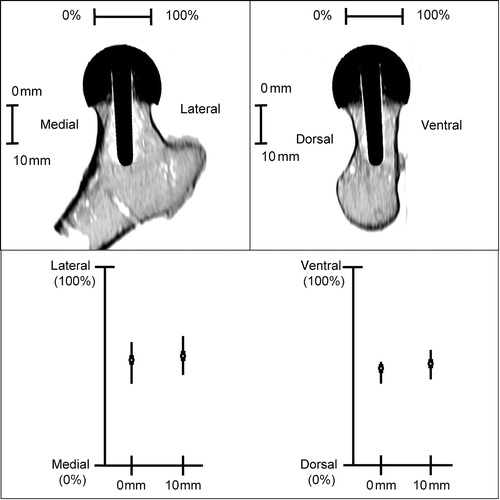 Figure 5. CT evaluation: Implant axis alignment (frontal and lateral view) in relation to femoral neck margins.