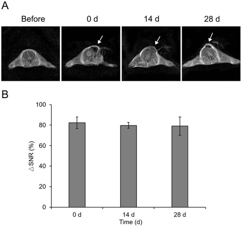 Figure 11 The typical T2-weighted MR images of the same mouse before, immediately after, at 14 d and 28 d after subcutaneous injection of FNMs into the back (A) and the quantificational analysis of signal-to-noise changes at the corresponding time points after the injection into three mice (B).Note: The arrows denoted the dark signal area induced by FNMs.Abbreviations: MR, magnetic resonance; FNMs, magnetic polymer microspheres; △SNR, the change of signal-to-noise ratio.