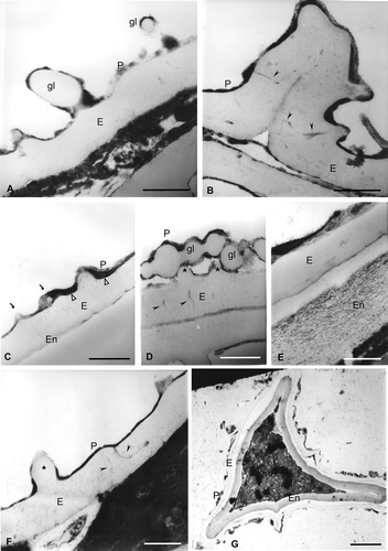Figure 4. Spores of Trichomanes under TEM. Wall sections of spores of Trichomanes hymenoides with different degree of maturation from a sporangium. The exospore is compact with irregular margin less contrasted than the perispore. In some spores a third wall is evident: the endospore (En). A. Two globules (gl) in section are visible, whereas a big one is fused to the exospore (E). They consist of: a thin outer wall of similar structure and contrast to that of the perispore (P) and an inner wall with the same contrast as that of the exospore; the perispore has areas with different contrast and is continuous in the whole surface. B. Section through a laesura. Channels are present at the edges of the commissure; in non-apertural areas some channels, both single or branched (arrowheads), are seen in connection with the perispore; processes of ornamentation are visible on the laesura surface. C. Globules are immersed in the perispore (P, arrows); membrane fragments (arrowheads) are in the base of the perispore. D. In this section, channels with a radial orientation within the exospore (arrowheads) are visible; two low processes (stars) are also visible; the perispore (P) in some areas has different contrast and thickness; numerous globules (gl) are free or fused to each other or to the perispore. E. A thick endospore (En) with a fibrilar structure is evident; the exospore (E) is compact and less contrasted than the perispore, while the perispore has different thickness, contrast and structure along the surface; the lighter areas have a structure formed of fibres while the dark areas have a compact structure. F. Within the exospore, the sculpture process appears (star). Large channels (arrowheads) with a dark content appear within the exospore and contact the perispore at several places. The perispore (P) is uniformly developed. G. In this spore the perispore (P) is thin, and irregularly developed along the surface; the exospore (E) has irregular margin. A thick, fibrilar endospore (En) is evident and the laesura is located in the lower part of the figure. Scale bars − 500 nm in all figures.