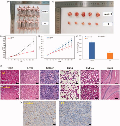 Figure 7. (a) Whole appearance and (b) the volume of tumor mice injected with PBS (control) and compound L1 after 25 days. (c) Change in tumor volume of mice injected with compound L1 (0.6 mg/kg) compared with PBS control. (d) Change in body weight of mice injected with compound L1 (0.6 mg/kg) and PBS. (e) The tumor weight of mice injected with compound L1 (0.6 mg/kg) and PBS control after 25 days. (f) H&E staining of the brain, heart, liver, spleen, lung, and kidney tissues collected from mice on the 25th day after an intravenous injection of compound L1 (0.6 mg/kg) and PBS control. (g) CD31 immumohistochemical staining with mice on the 25th day after an intravenous injection of compound L1 (0.6 mg/kg) and PBS control. Scale bar = 20 μm; error bars are based on standard errors of the mean (n = 5).